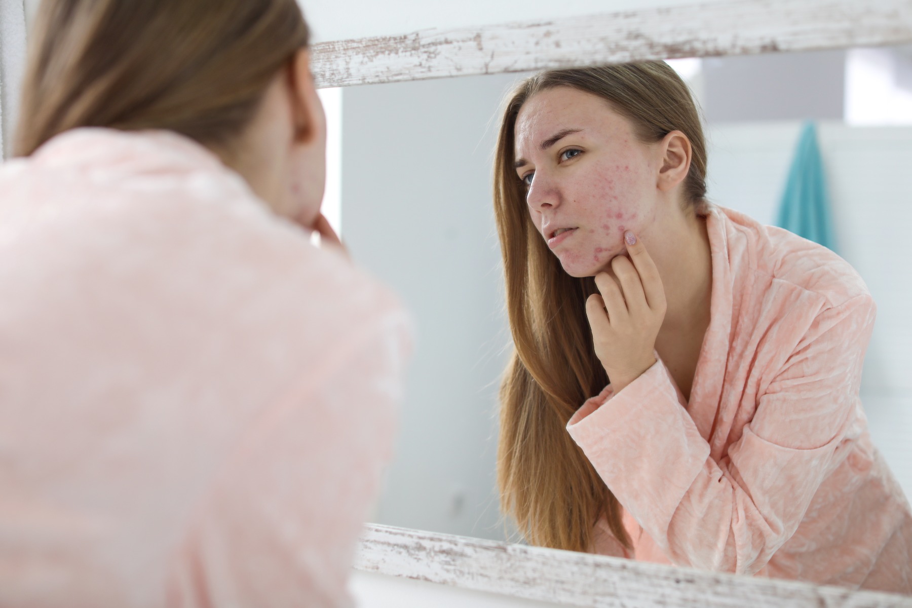 Antibacterial to reduce acne