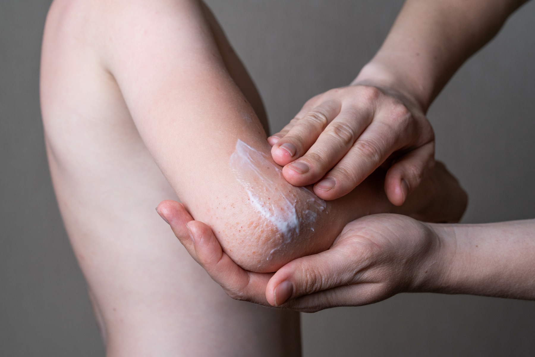 Best Products For Eczema